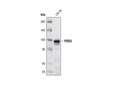 PDE5 Antibody