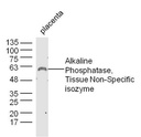 碱性磷酸酶(组织非特异性)抗体